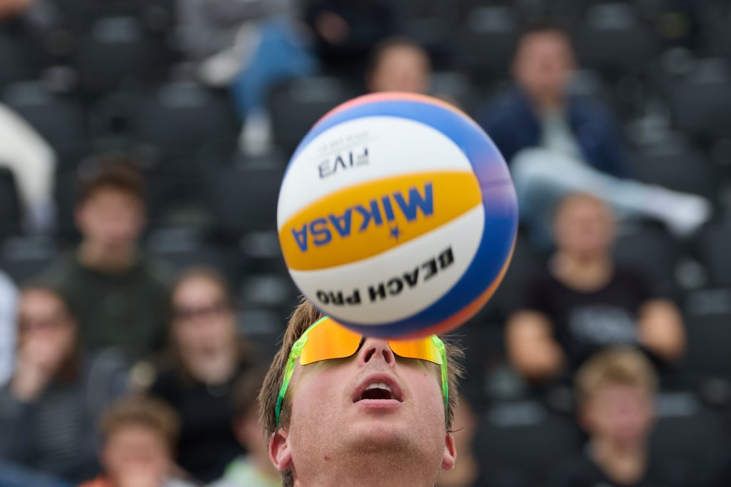 En mann med soleksem ser opp på en volleyball som svever over hodet hans, med tilskuere i bakgrunnen.